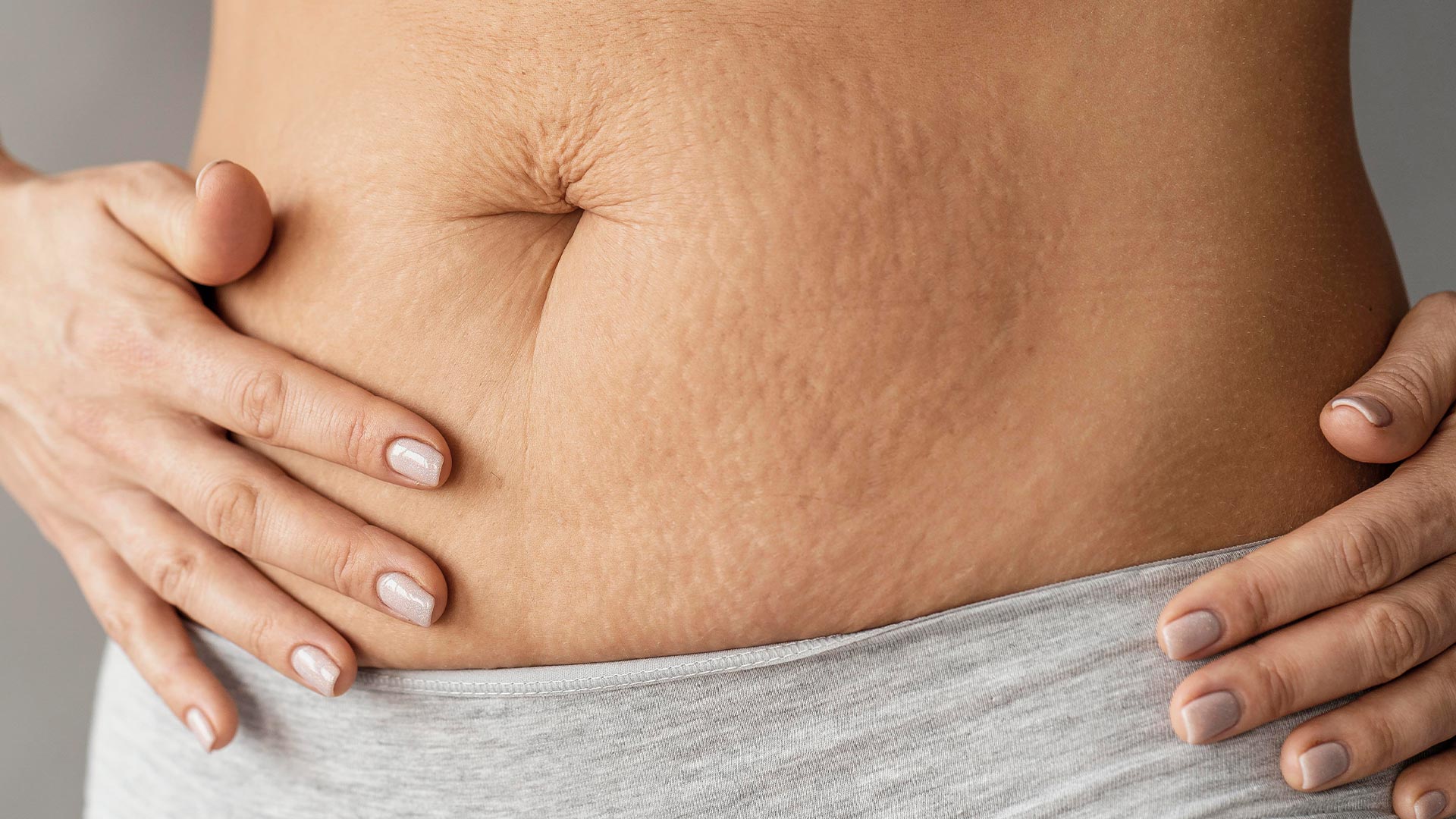 علاج السيلوليت وتحسين ملمس الجلد وتنشيط التصريف اللمفاوي — ضمن خدمات مركز الوزن المثالي أبو ظبى